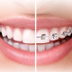 ortodontics